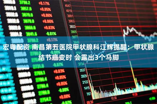 宏粤配资 南昌第五医院甲状腺科江辉提醒：甲状腺结节癌变时 会露出3个马脚